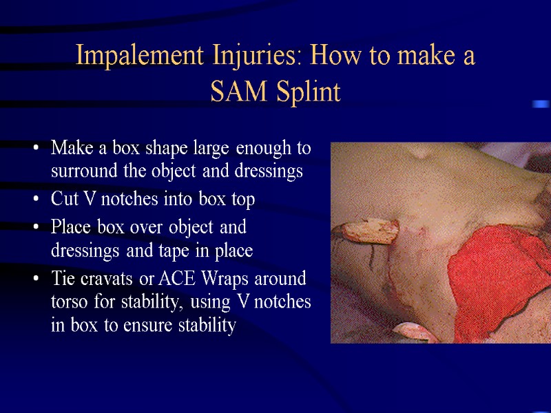 Impalement Injuries: How to make a SAM Splint Make a box shape large enough